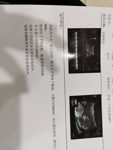 journal_insert_pic_1677219124