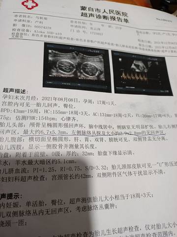 journal_insert_pic_1675047956