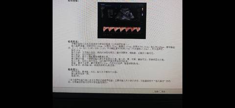 journal_insert_pic_1682124395