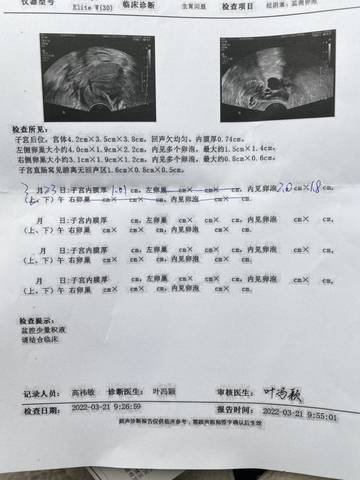 journal_insert_pic_1740812552