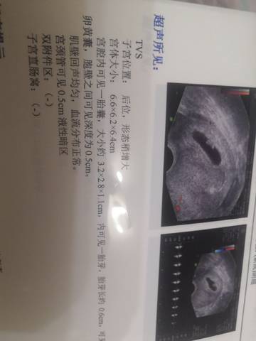 journal_insert_pic_1686065100