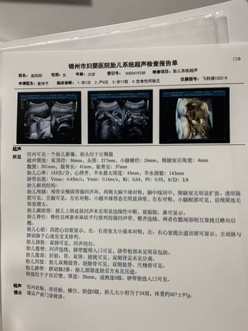 journal_insert_pic_1688536751