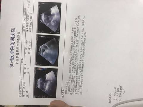 journal_insert_pic_1687326177