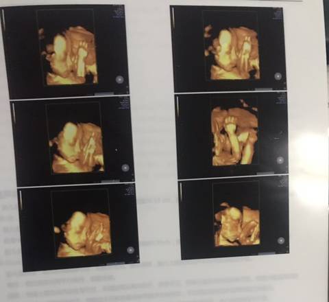 journal_insert_pic_1682642745