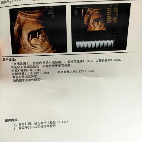 journal_insert_pic_1682126364