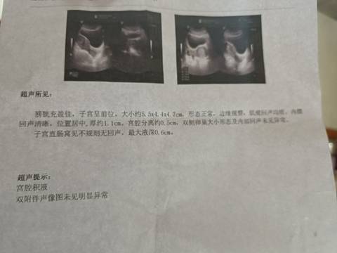 journal_insert_pic_1674743717