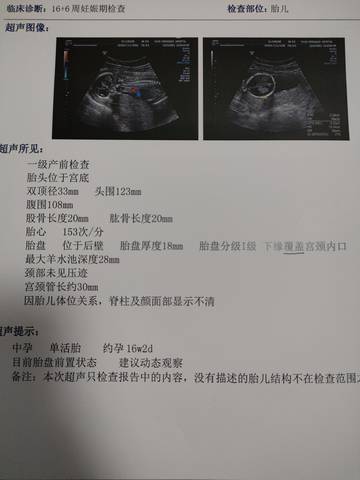 journal_insert_pic_1689620514