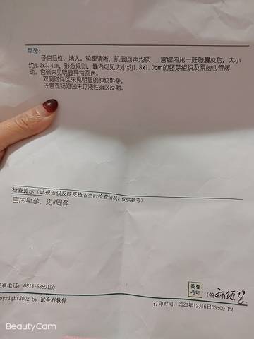 journal_insert_pic_1676110278