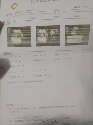 journal_insert_pic_1679249316