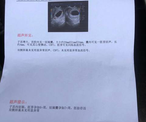 journal_insert_pic_1683045296