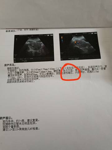 journal_insert_pic_1688514867