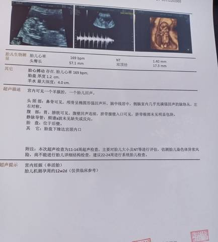 journal_insert_pic_1683142939