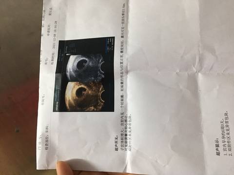journal_insert_pic_1676224756