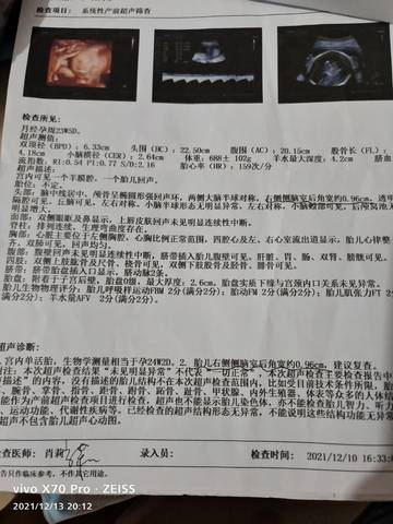 journal_insert_pic_1679282283