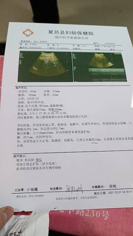 journal_insert_pic_1689552489