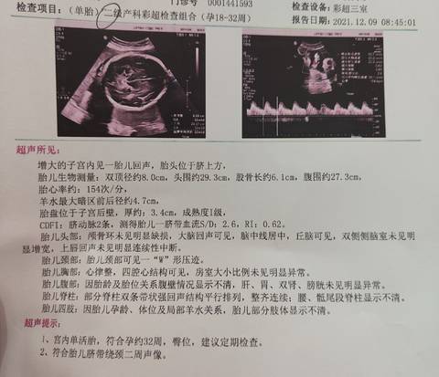 journal_insert_pic_1677236556