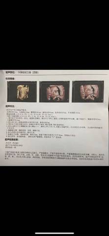 journal_insert_pic_1688092262