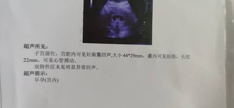 journal_insert_pic_1719520011