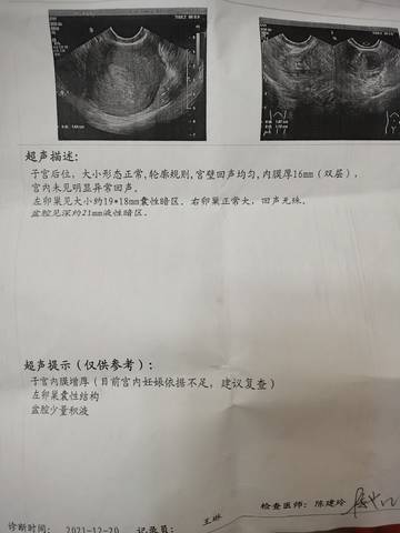 journal_insert_pic_1689128979