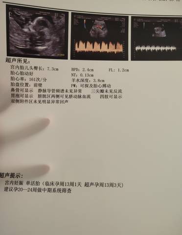 journal_insert_pic_1686746355