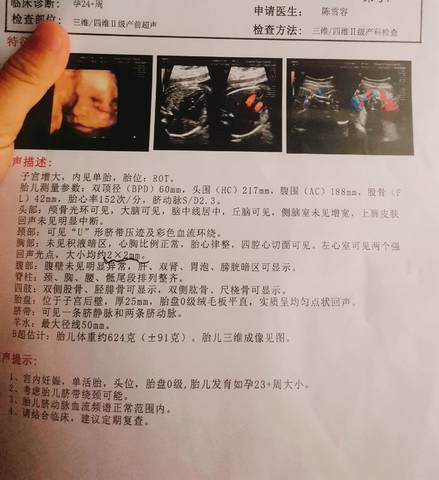journal_insert_pic_1676725561
