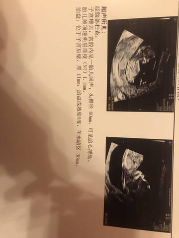 journal_insert_pic_1683139822