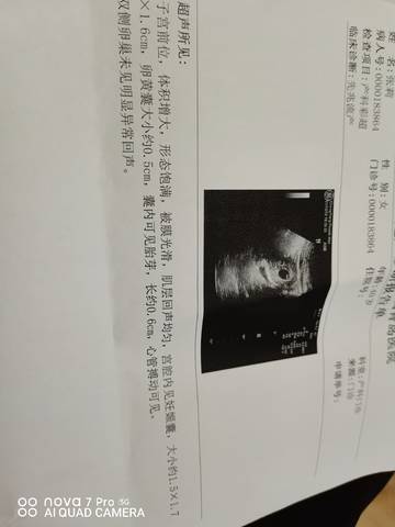 journal_insert_pic_1682353585