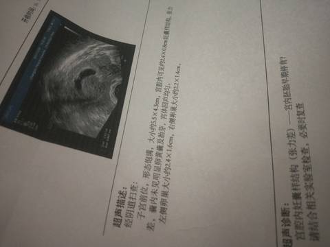 journal_insert_pic_1674946711