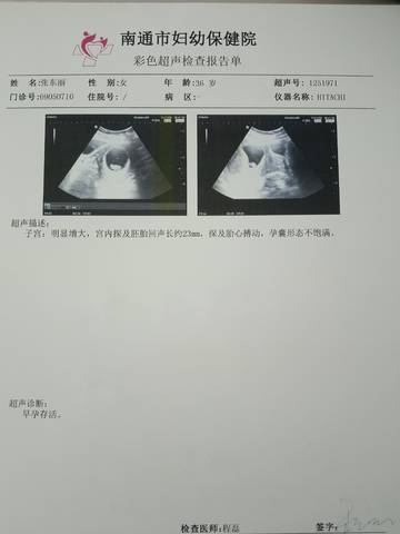 journal_insert_pic_1682940525