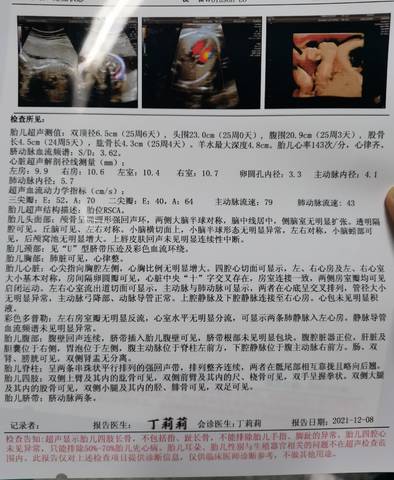 journal_insert_pic_1677078062