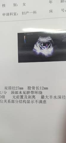 journal_insert_pic_1690546070
