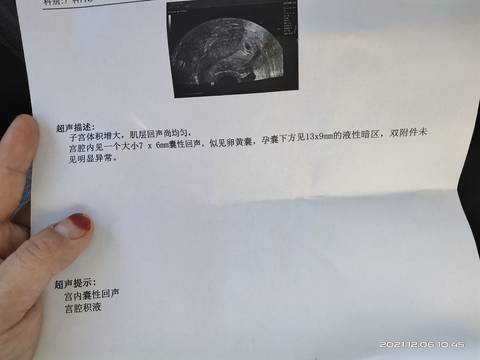 journal_insert_pic_1674686669