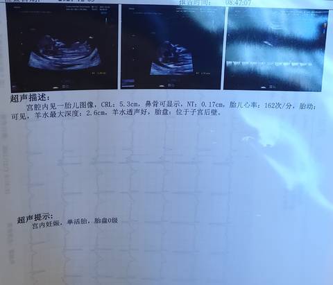 journal_insert_pic_1677620253