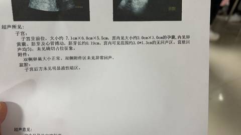 journal_insert_pic_1719467169