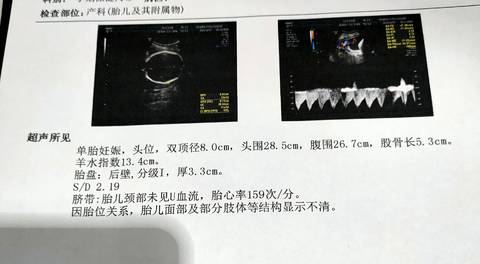 journal_insert_pic_1686937507