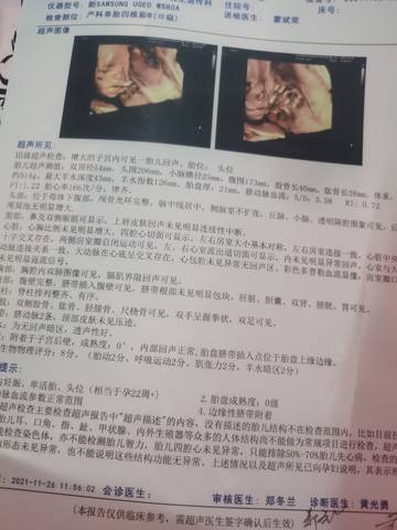 journal_insert_pic_1675676470