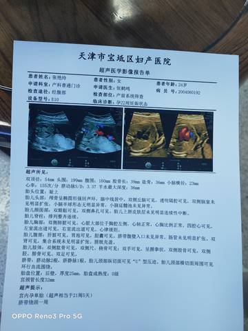 journal_insert_pic_1674735187