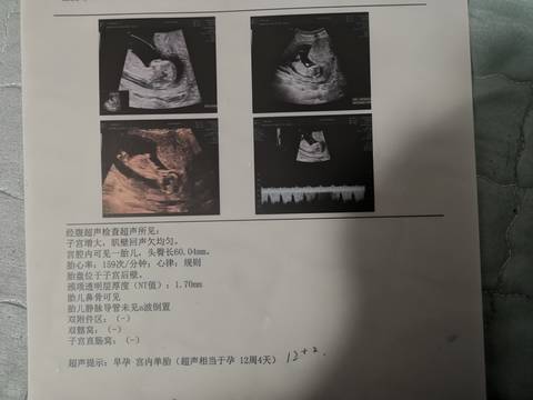 journal_insert_pic_1683536581