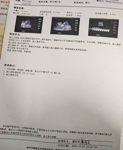 journal_insert_pic_1677024095