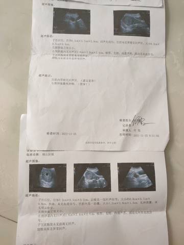 journal_insert_pic_1677312766