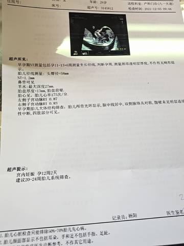 journal_insert_pic_1674010839