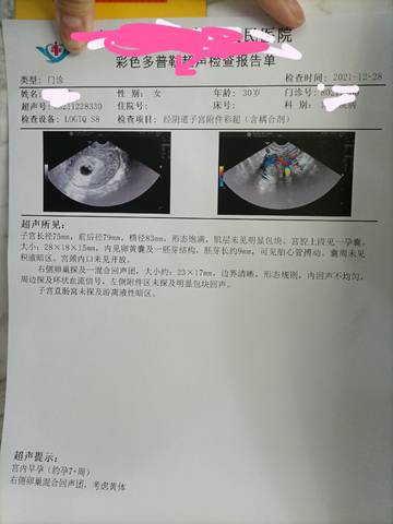 journal_insert_pic_1687887424