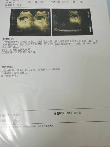 journal_insert_pic_1684970441
