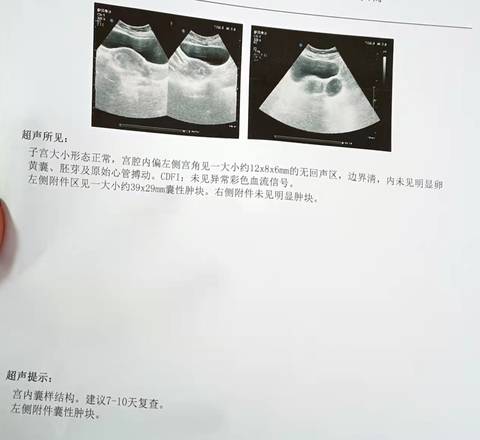 journal_insert_pic_1673269410