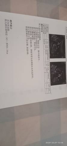 journal_insert_pic_1686975818