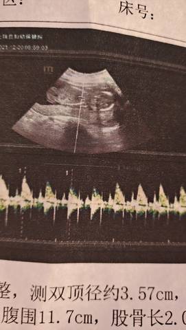 journal_insert_pic_1683081573