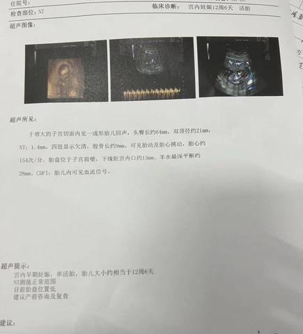 journal_insert_pic_1681054170