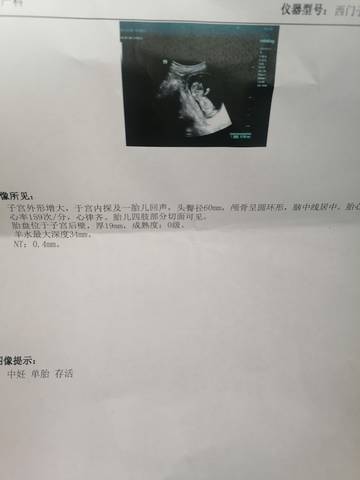 journal_insert_pic_1687593504
