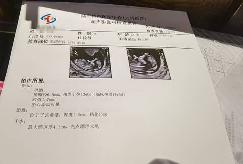 journal_insert_pic_1678095312