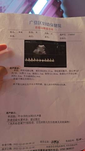 journal_insert_pic_1683081560